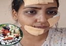 पुणे: पतीने ब्लेडने हल्ला केलेली जखमी पीडित तरुणी आणि आरोपी पतीचा फोटो; औंध रोडवरील थरार.